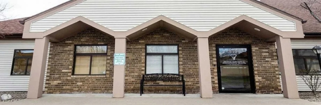 Dental Implants and Periodontal Health