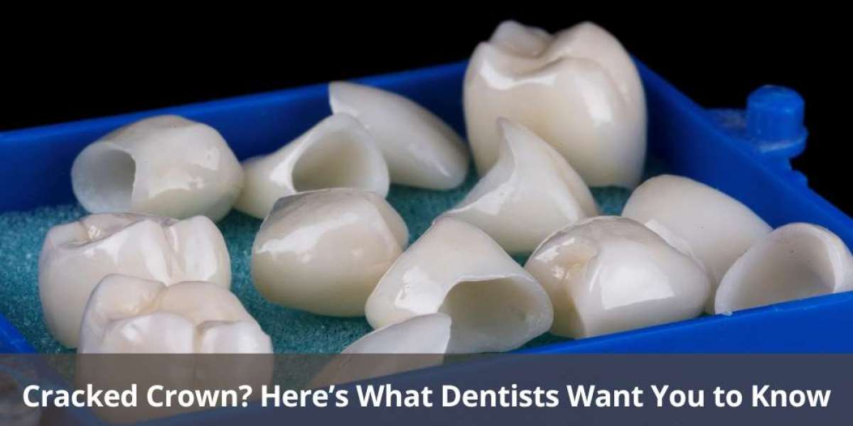 Cracked Crown? Here’s What Dentists Want You to Know