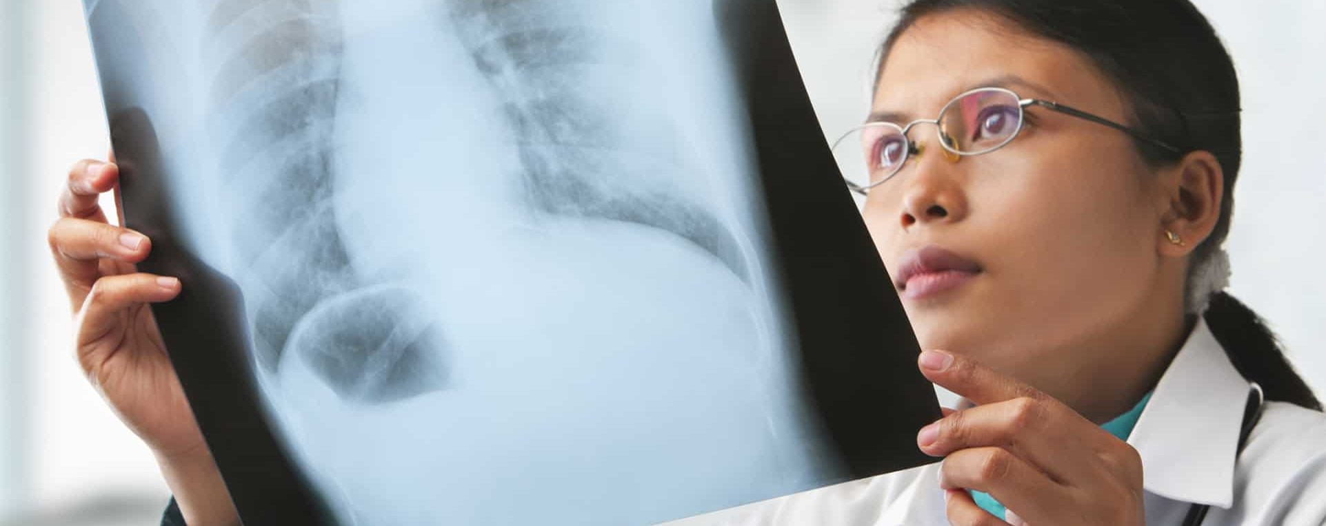 Chest X-Rays and B Read for Occupational Health