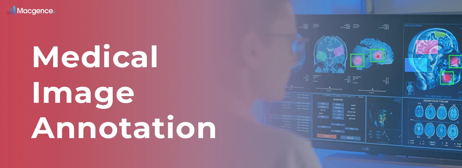 Medical Image Annotation by Macgence AI