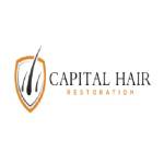 capitalhairrestoration