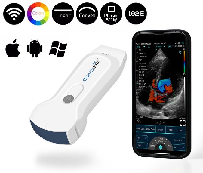 3-in-1 Color Doppler USB & Wireless Ultrasound Scanner