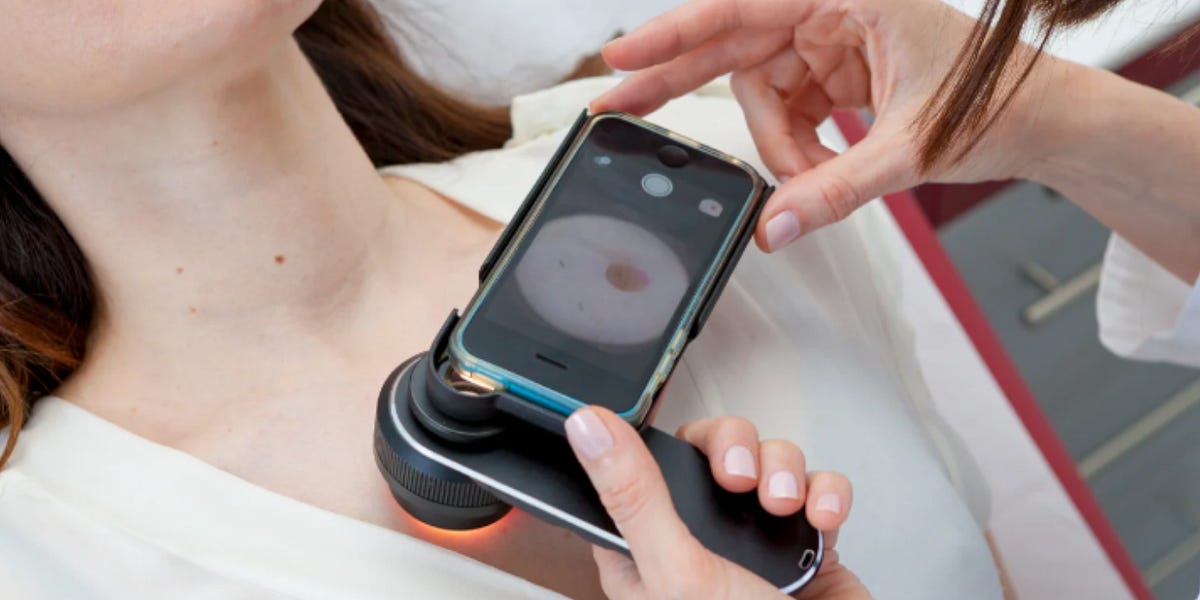 Small lump removal Maidenhead